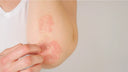 Choisir la bonne lessive pour éviter l'eczéma avec Senza Nature