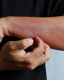 La meilleure lessive anti-allergie : guide complet pour peaux sensibles et allergies