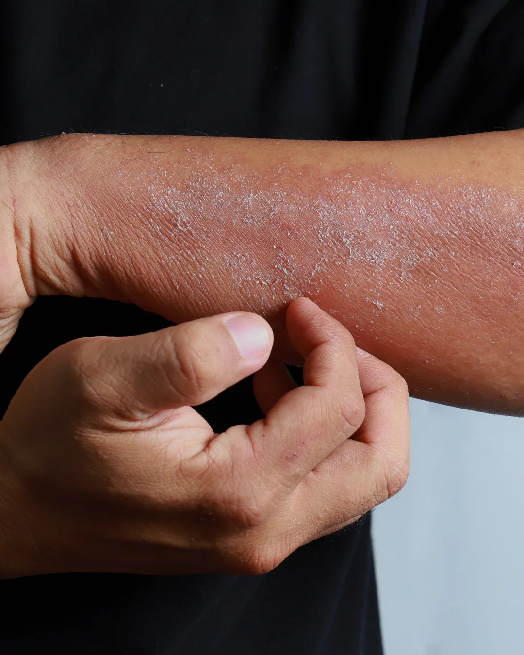 Lessive anti-allergie par Senza nature
