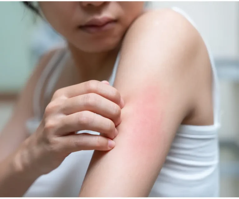 Lessive et Peau - comprendre le lien pour mieux se protéger