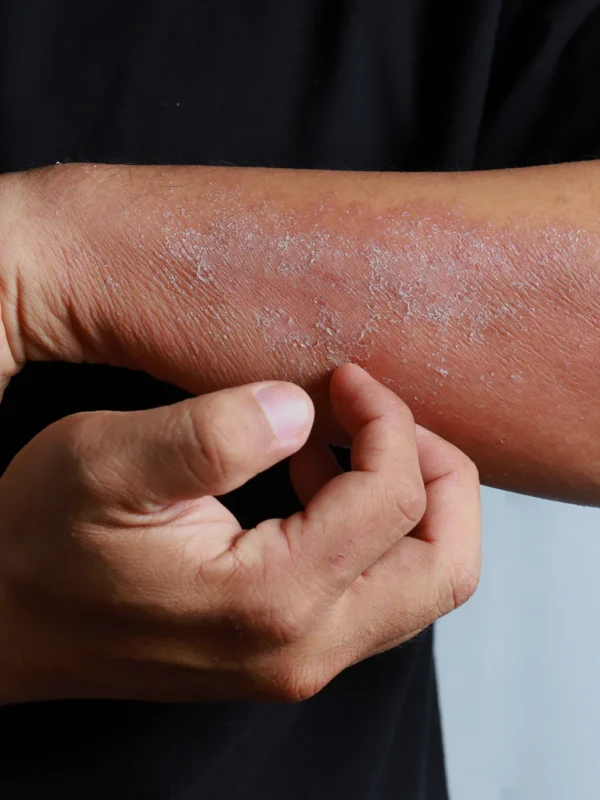Lessive anti-allergie par Senza nature